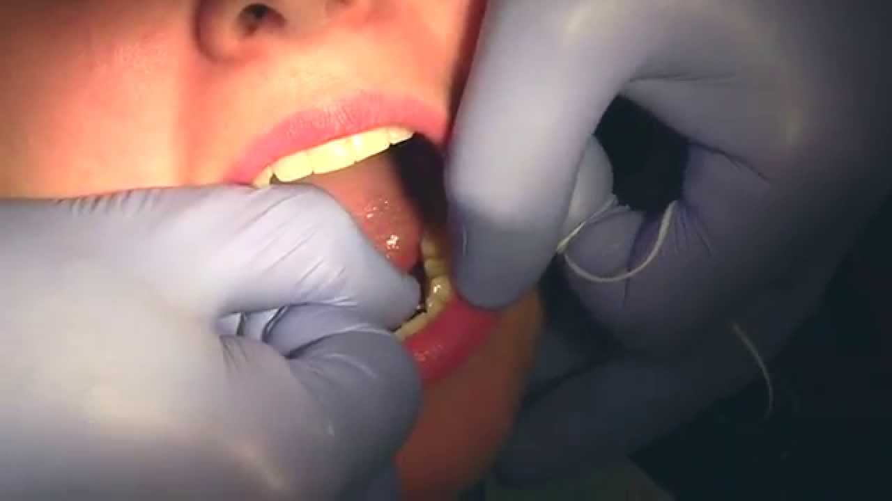 Jak poprawnie myć zęby? Jak prawidłowo nitkować zęby? Dentysta Robert Michalak 22 651 84 64