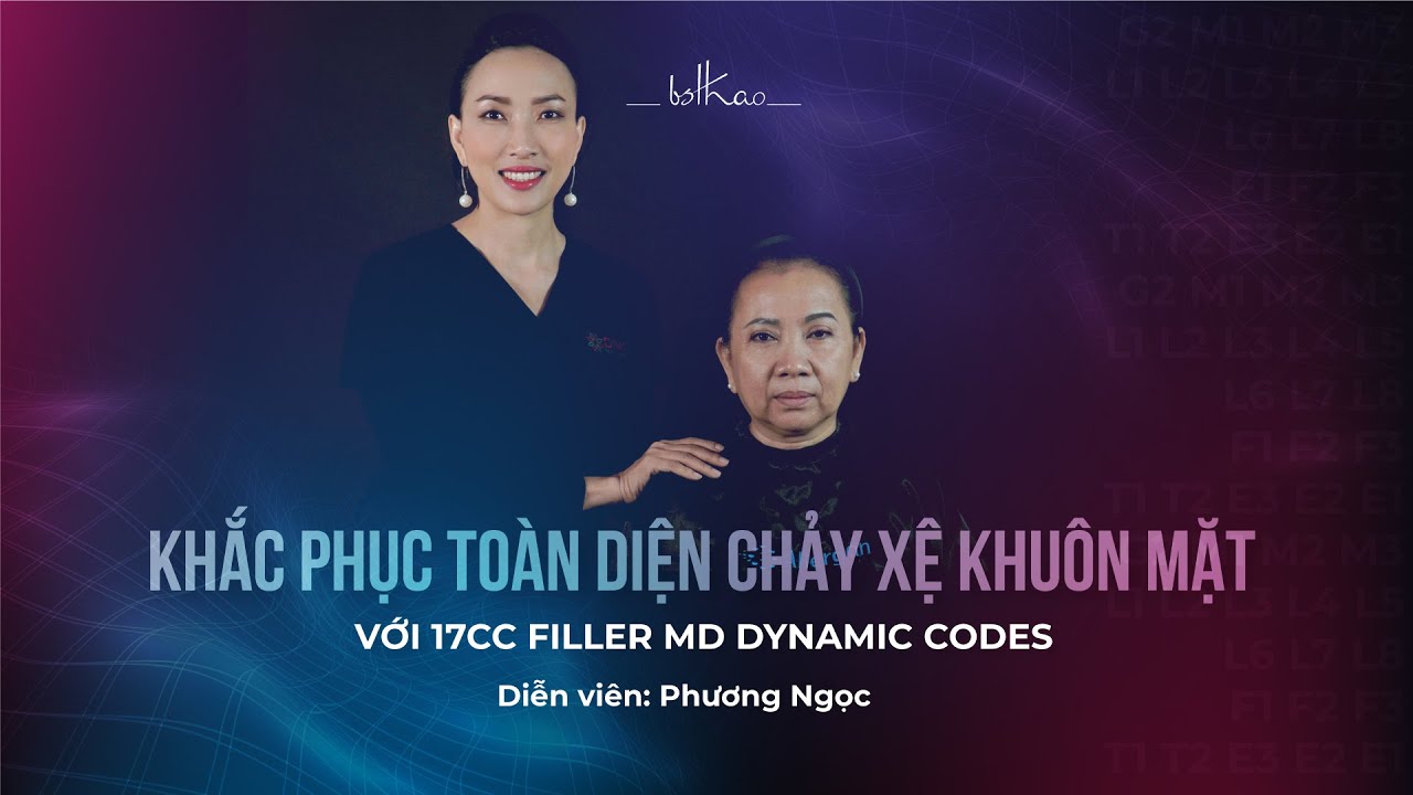 [Bác sĩ Thảo] KHẮC PHỤC CHẢY XỆ CHO ĐỘ TUỔI 50 CHỈ SAU 1H VỚI 17CC FILLER MD DYNAMIC CODES