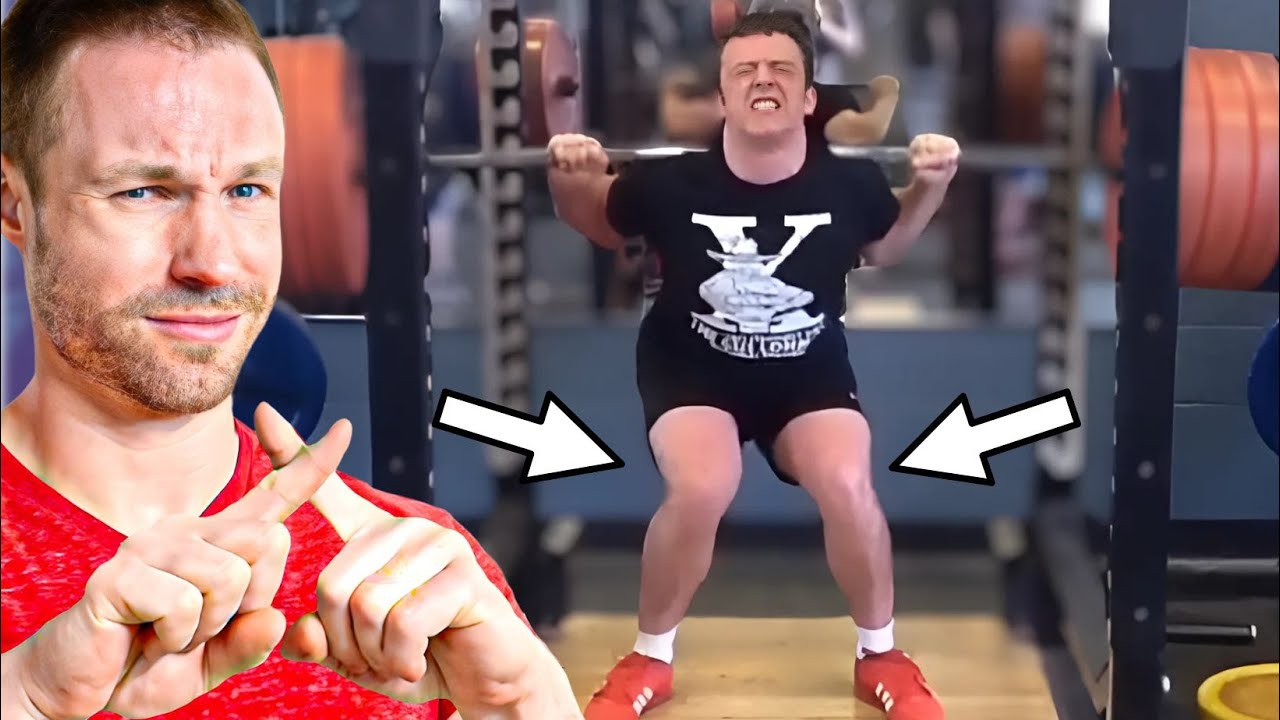 Knee Valgus Explained: Fix Knee Cave and Boost Your Strength