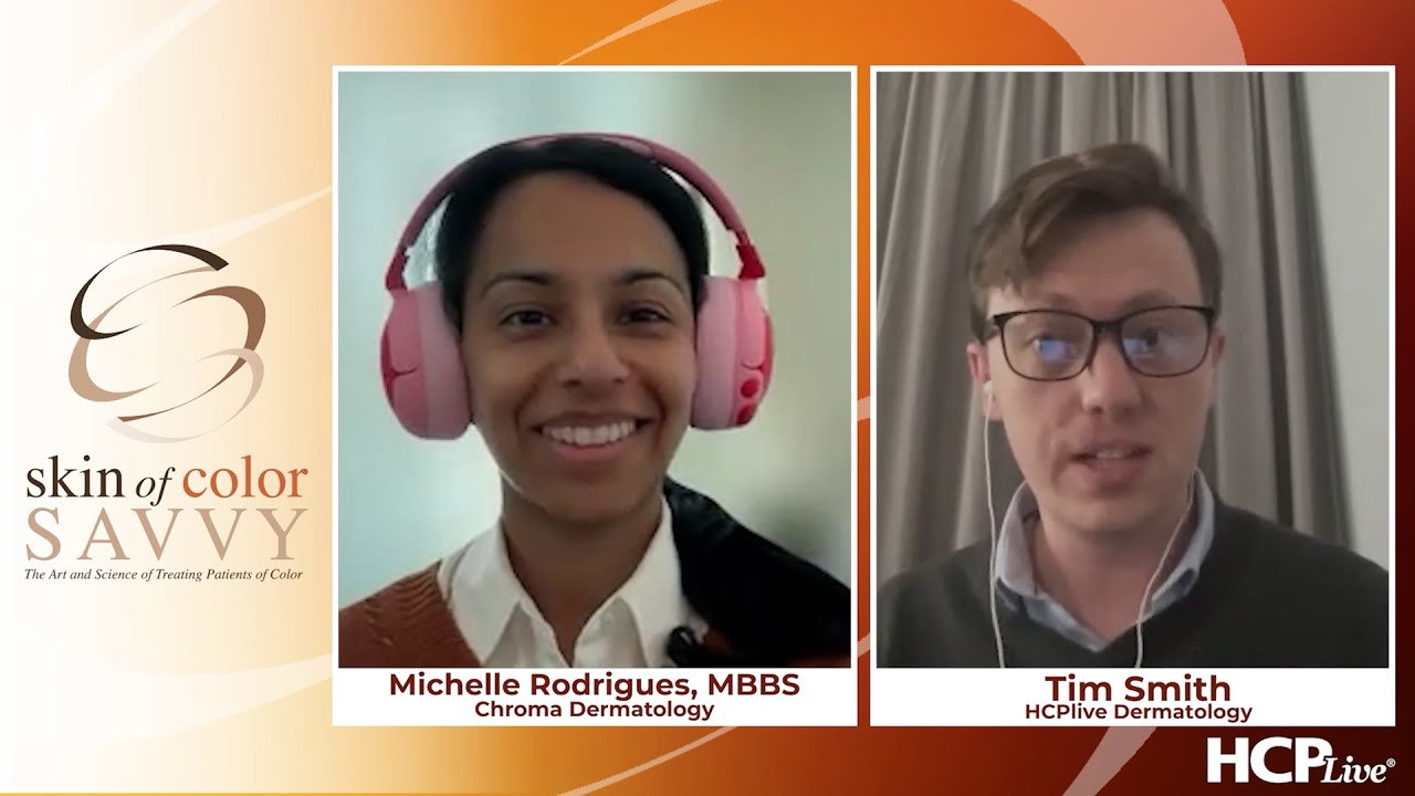 Skin of Color Savvy: Insights on Hyperpigmentation from EADV, With Michelle Rodrigues, MBBS