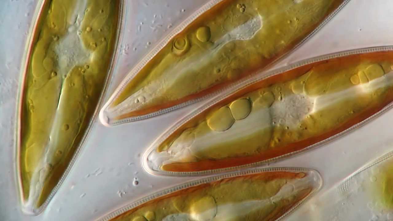 Stauroneis Diatom / DIC Microscope 1250x