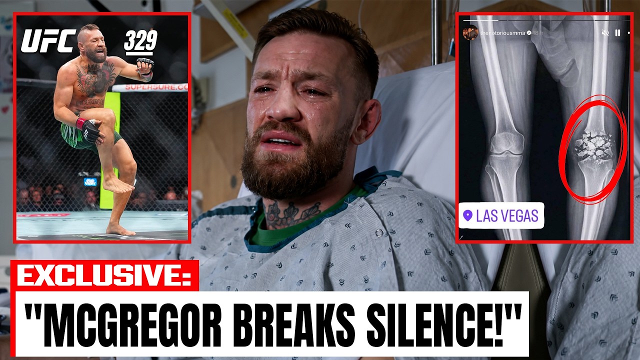 Conor McGregor Breaks Silence After BRUTAL LEG INJURY Against Max Holloway at UFC 329!