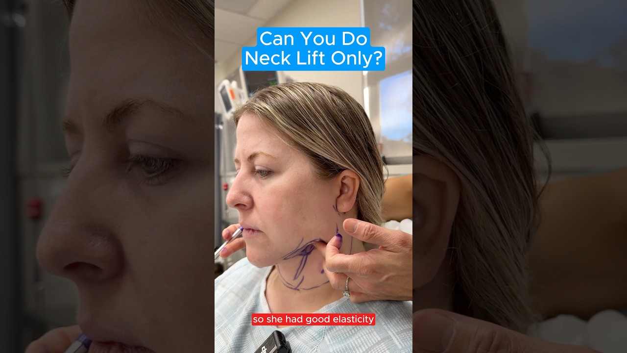 Can You Do Neck Lift Only? #facelift