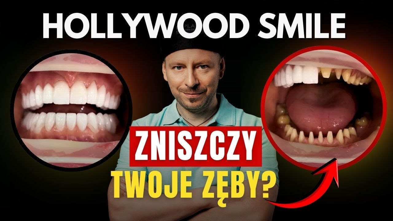 Musisz to wiedzieć zanim zrobisz licówki i korony - ciemna strona Hollywood Smile.