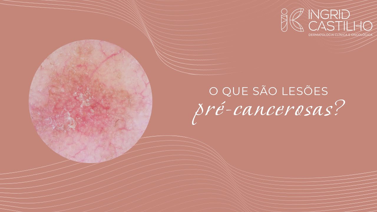 O que são lesões pré-cancerosas?