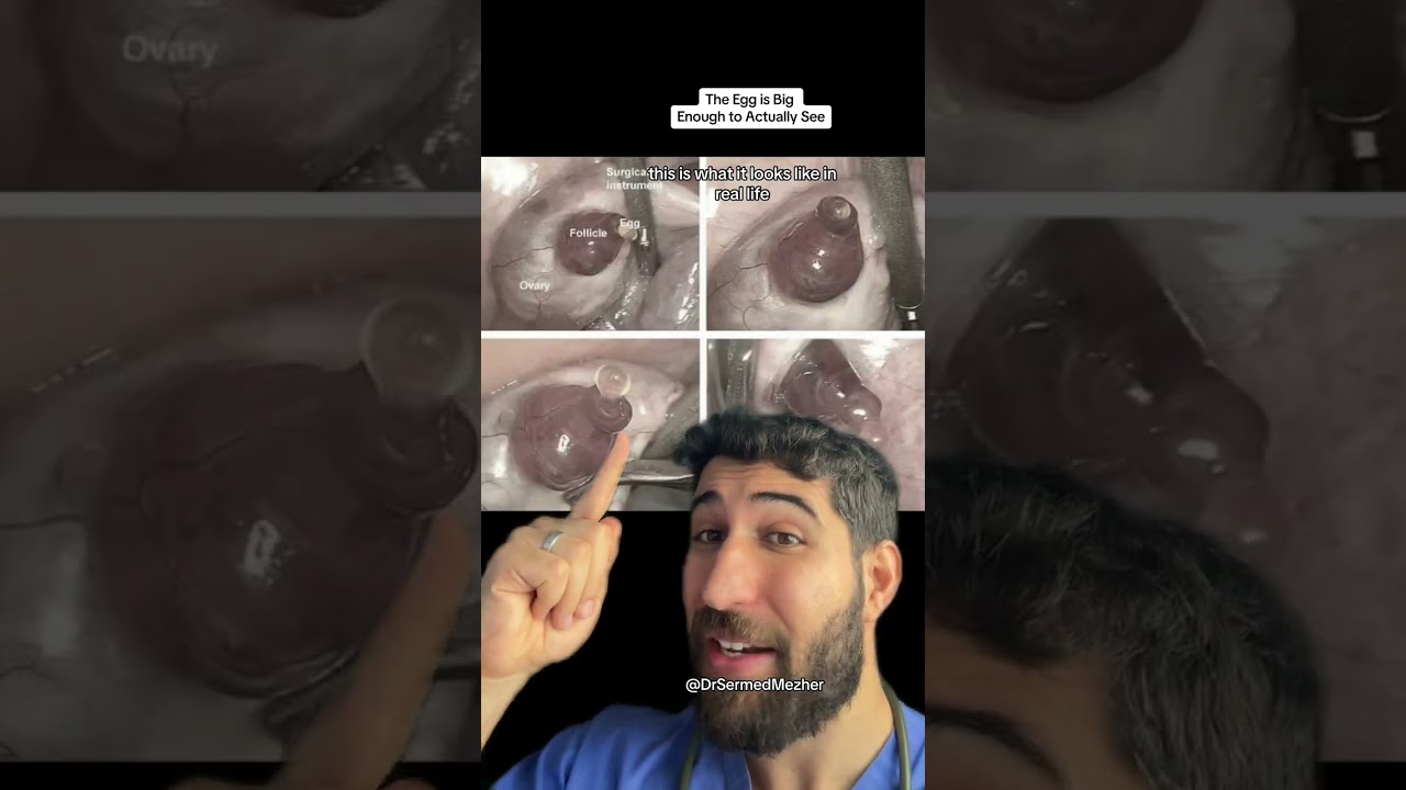 The Human Egg is Bigger Than You Think #pain
