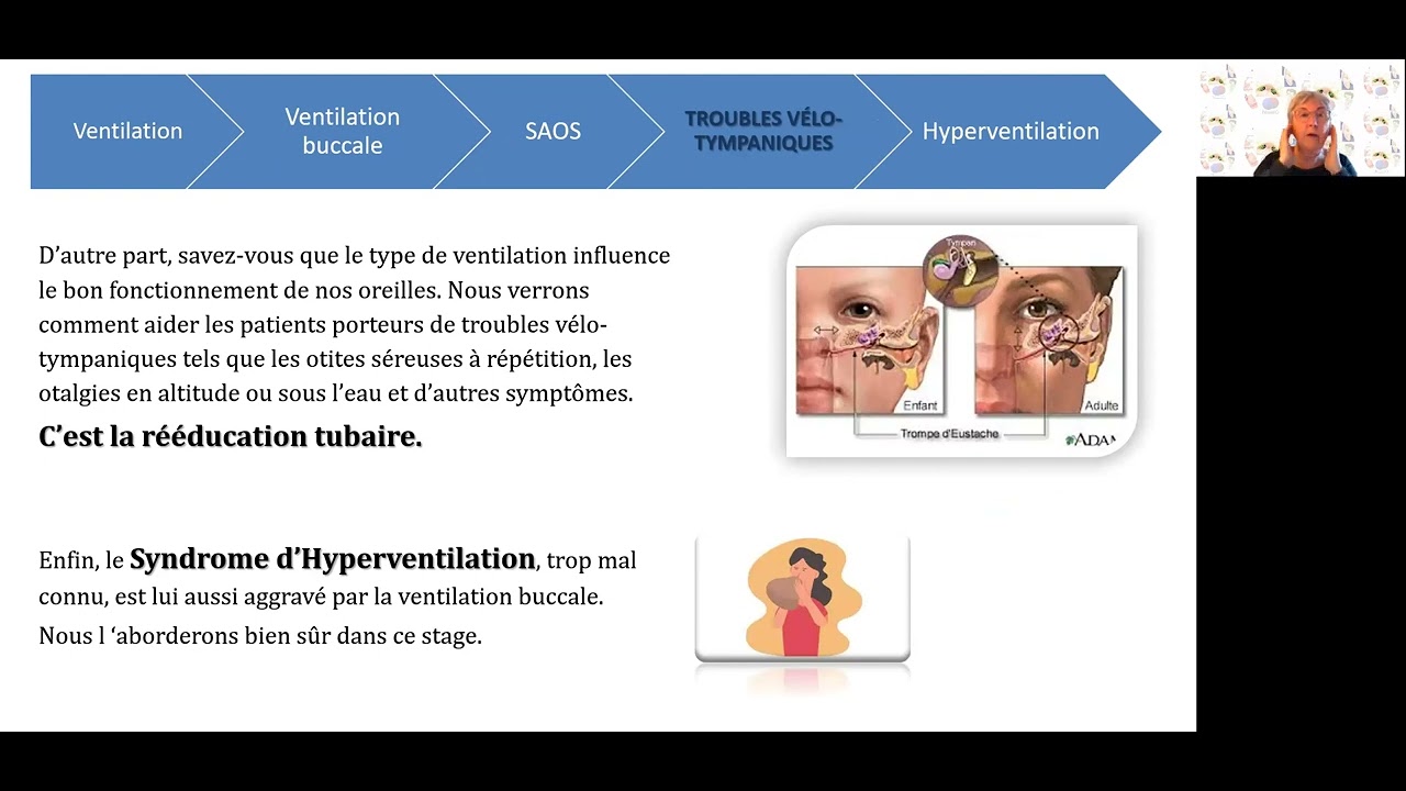 Présentation stage VENTILATION, Syndrome d’APNÉES OBSTRUCTIVES du SOMMEIL.