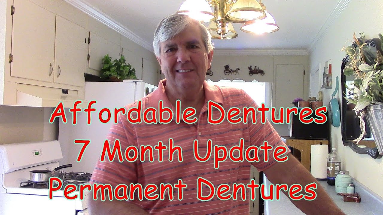 Affordable Dentures 7 Month Update  Permanent Dentures