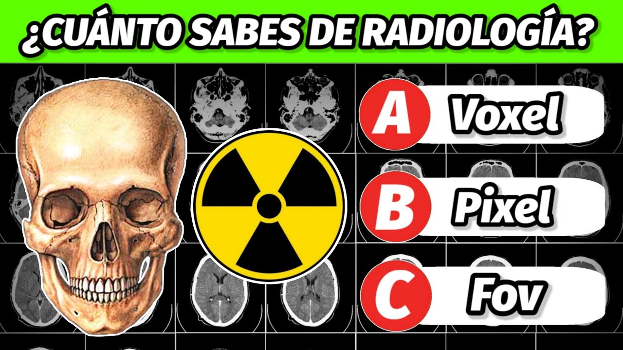 Test de Radiología: ¿Estás Listo para Resolver Estas 30 Preguntas? 🔥