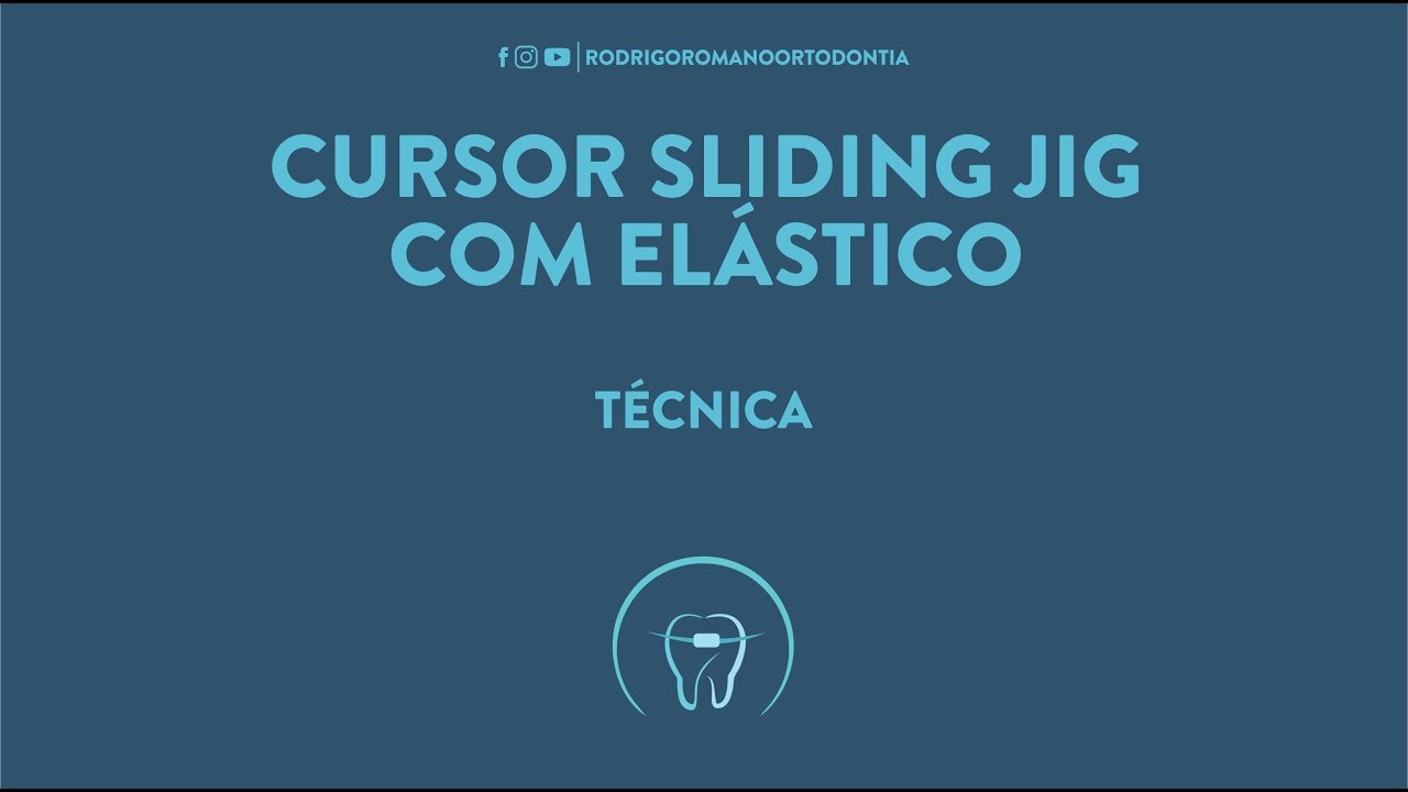 Cursor Sliding Jig com elástico - Técnica Ortodôntica