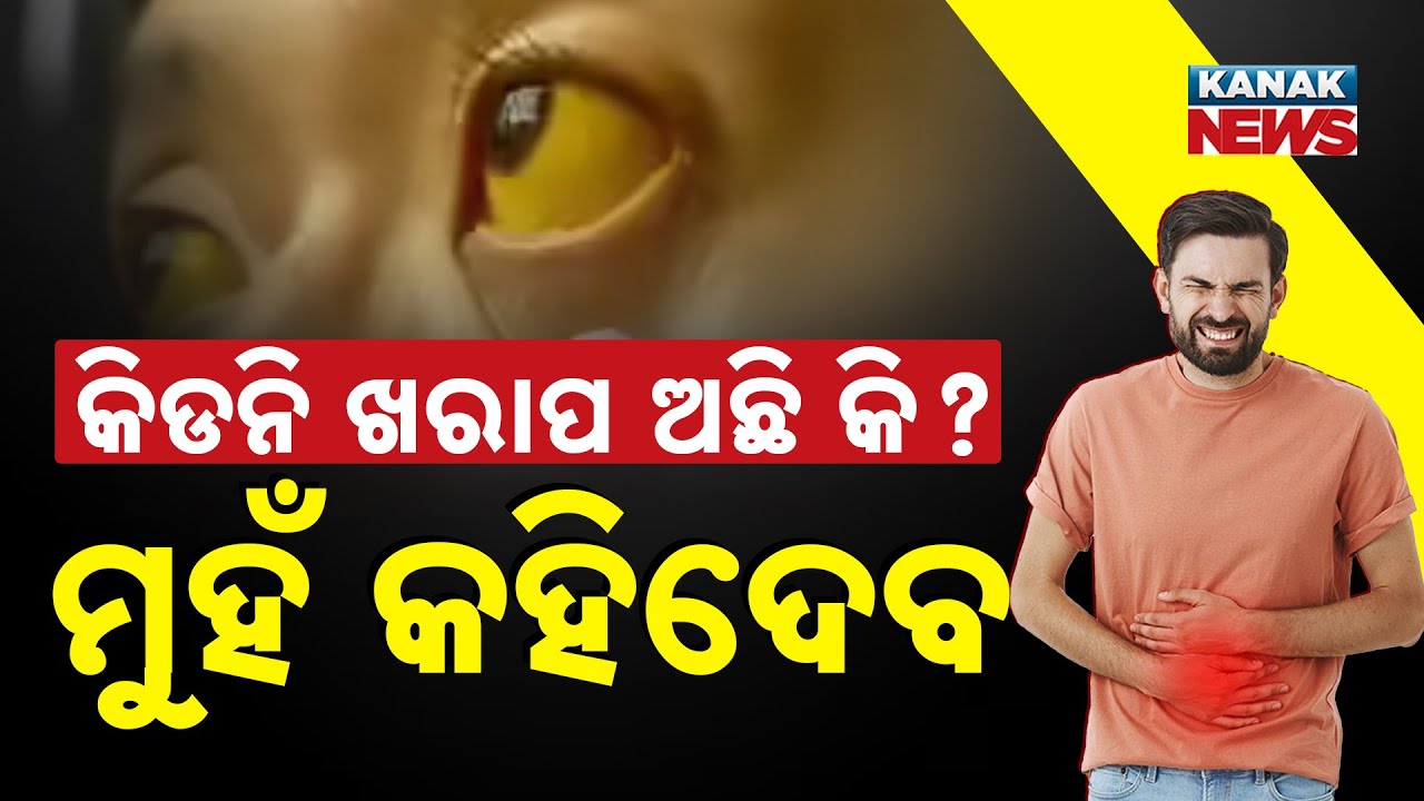 Special Report: Know Your Kidneys! What Your Face Is Telling You About Your Kidney Health