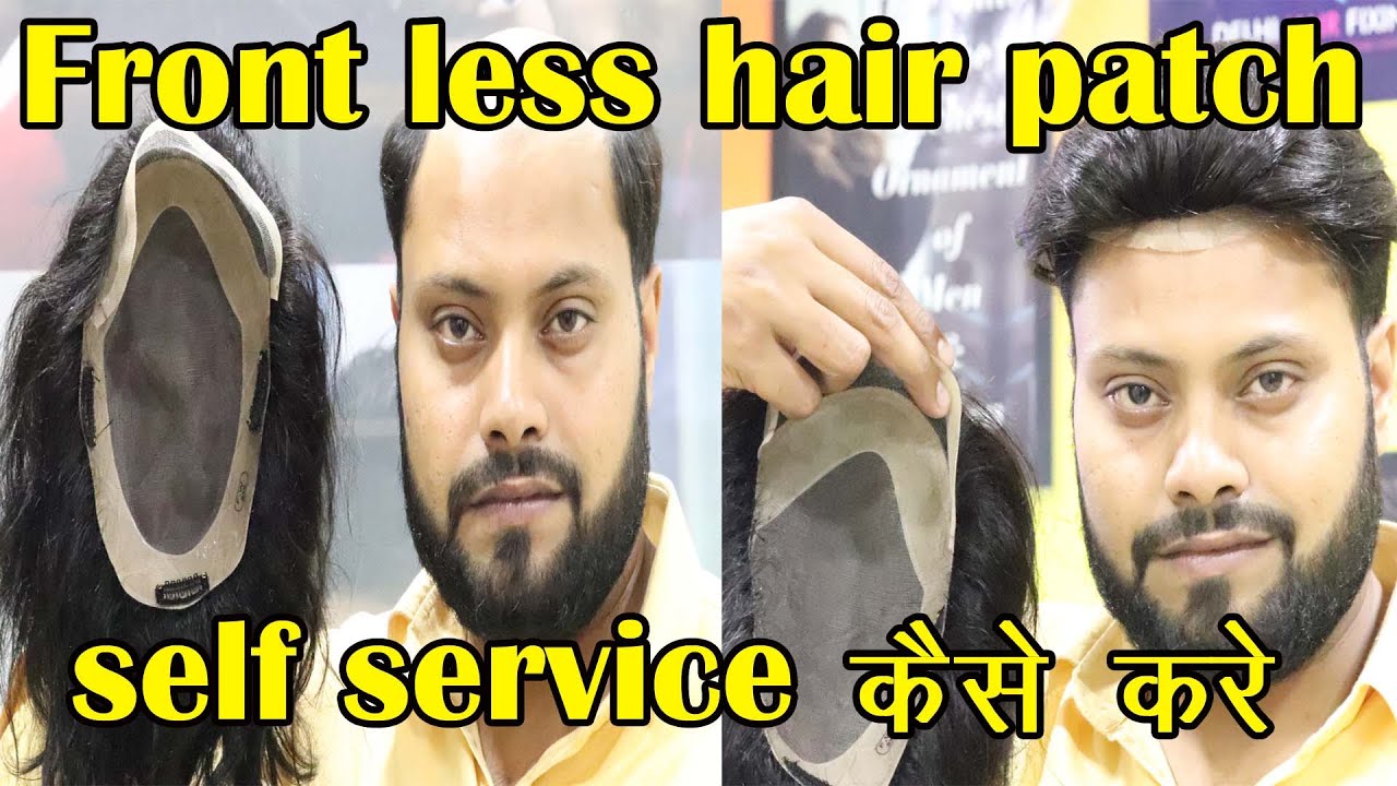 Can you do self - service in front less hair patch? by Abdul Rehman in delhi |call us – 9873152223