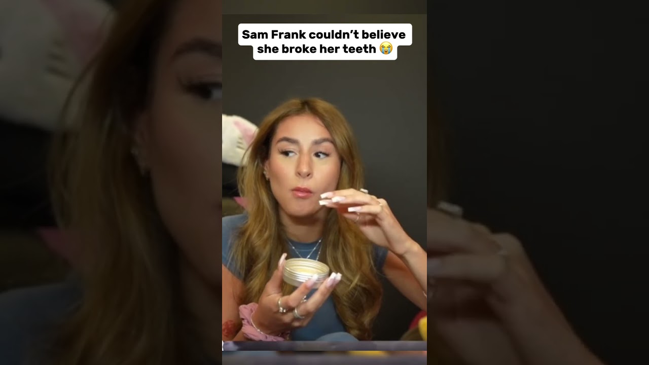 Sam Frank couldn&rsquo;t believe she broke her teeth #samfrank #samxfrank