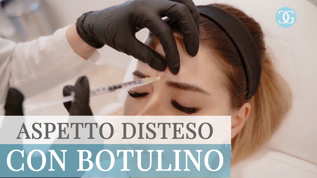 TOSSINA BOTULINICA per trattare rughe di espressione - Dr.ssa Beatrice Giorgini