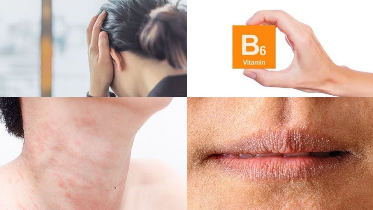 علامات تخبرك أنك تعاني من نقص فيتامين  B6