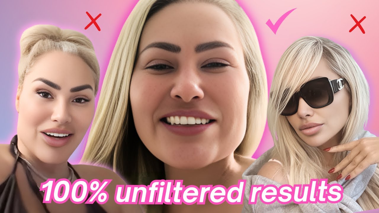 Darcey & Stacey’s Facelift REAL Results & Secret Tea (Alleged)