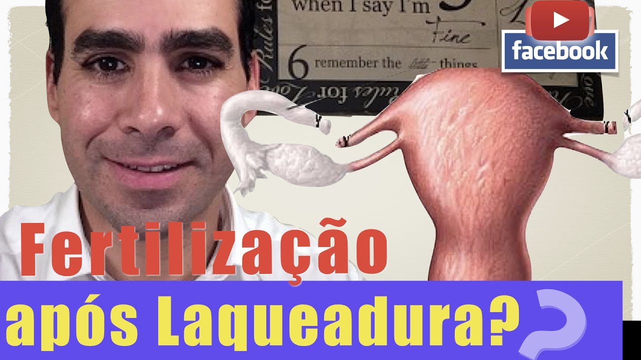 🔴AO-VIVO- Fertilização in-vitro após LAQUEADURA!