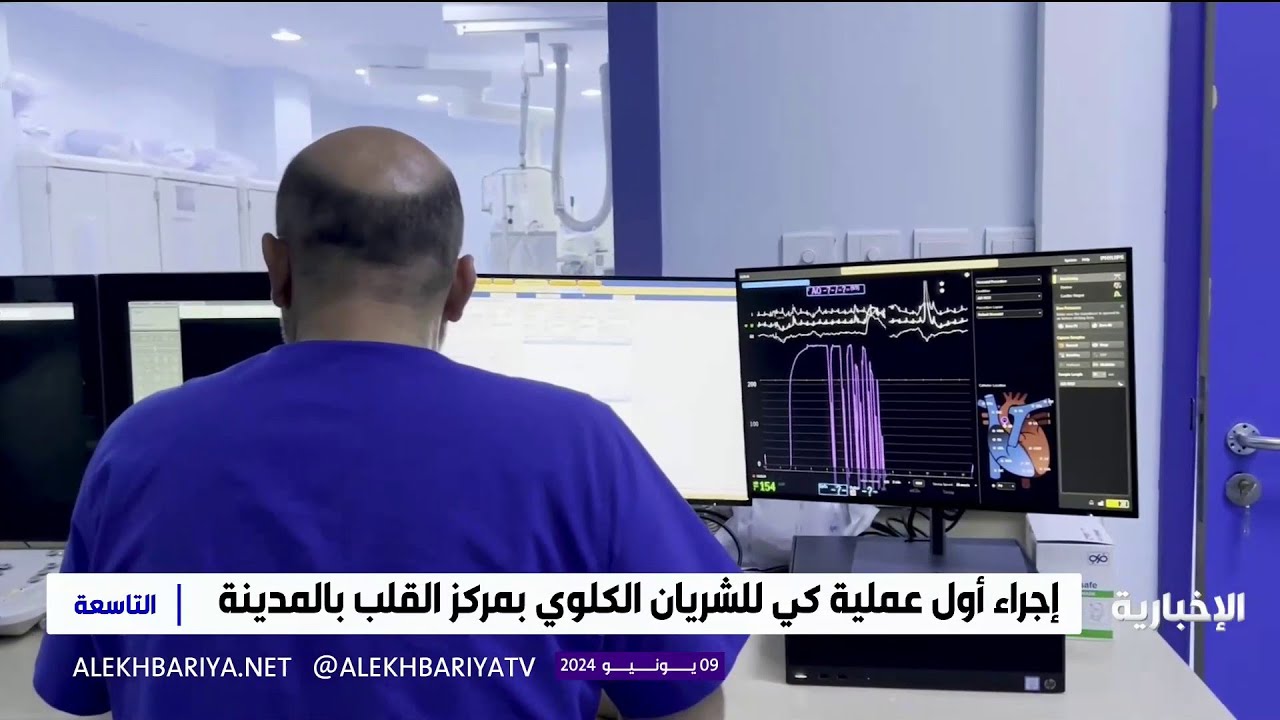إجراء أول عملية  كي للشريان الكلوي في مركز القلب بالمدينة