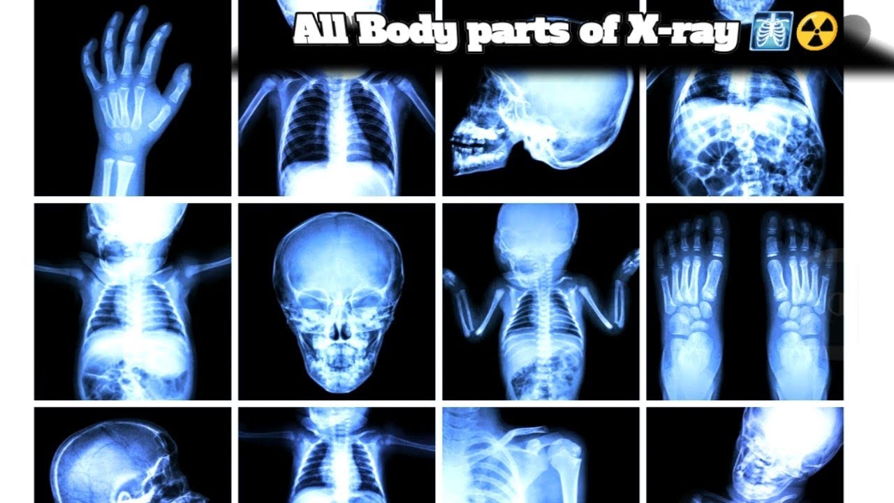 All body parts of the X-ray view ☢️ 