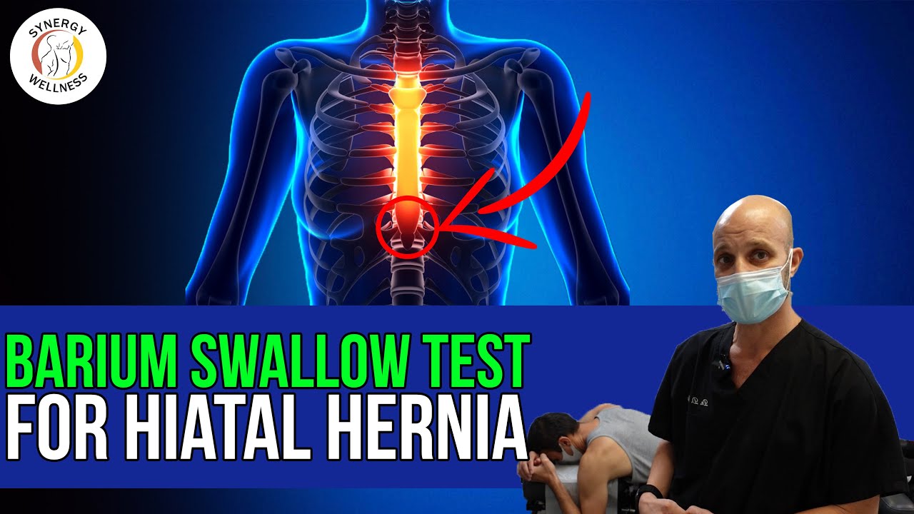 Barium Swallow Test for Hiatal Hernia