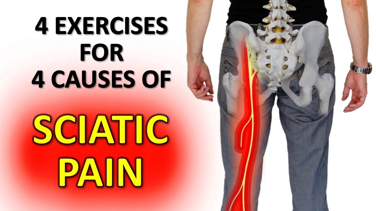 4 Exercises For Quick Sciatic Leg Pain Relief