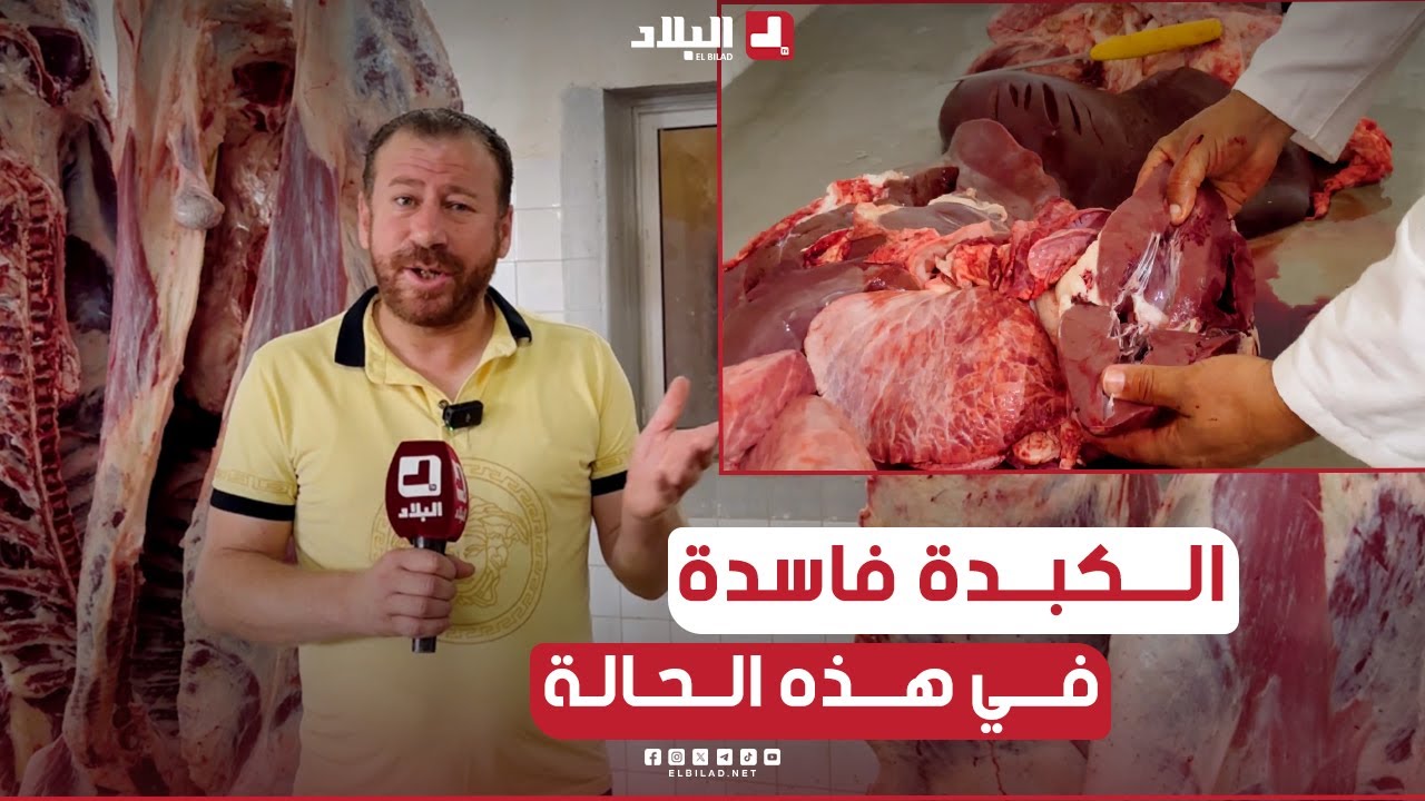 📌#طبيب_بيطري يتحدث عن الطريقة الصحيحة والمؤشرات لمعرفة  إلا الكبد تاع الكبش فاسد شاهدوا