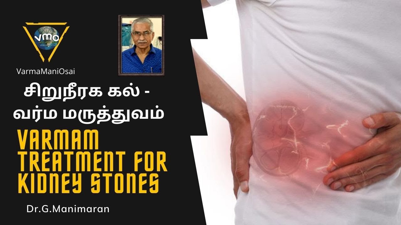 சிறுநீரகப்பிரச்சனை/சிறுநீரக கல்- வர்ம மருத்துவம் - kidney problems and stone | Dr.G.Manimaran