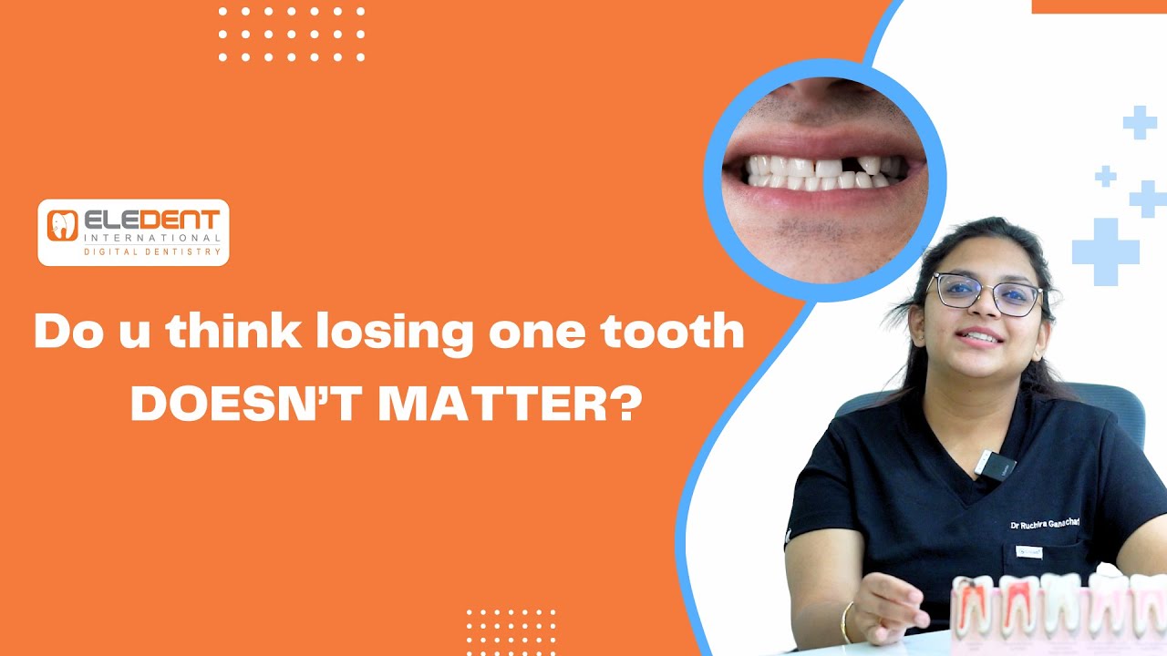 Why Should Replace A Missing Tooth? #missingtooth