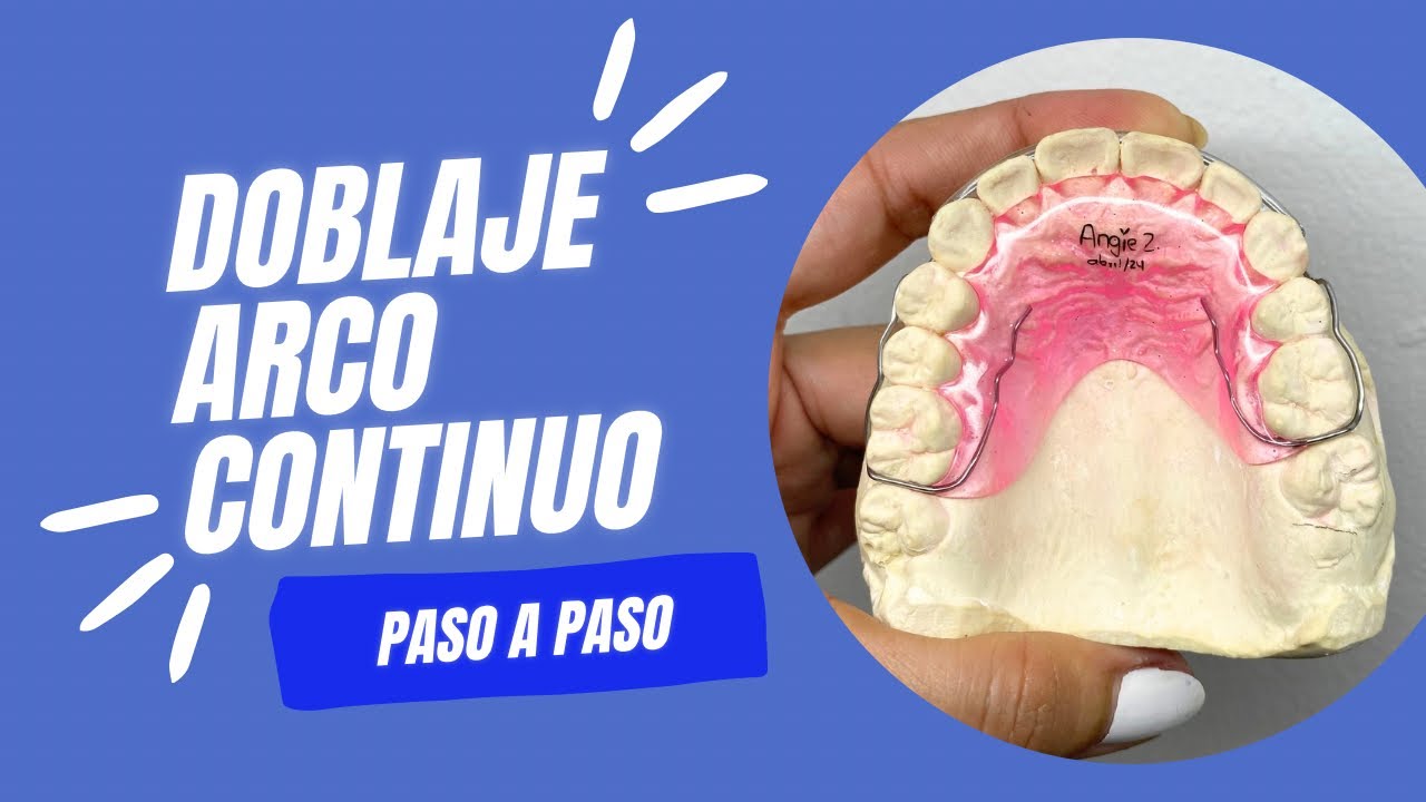 ✅ ARCO CONTINUO O CIRCUNFERENCIAL✅ Método sencillo