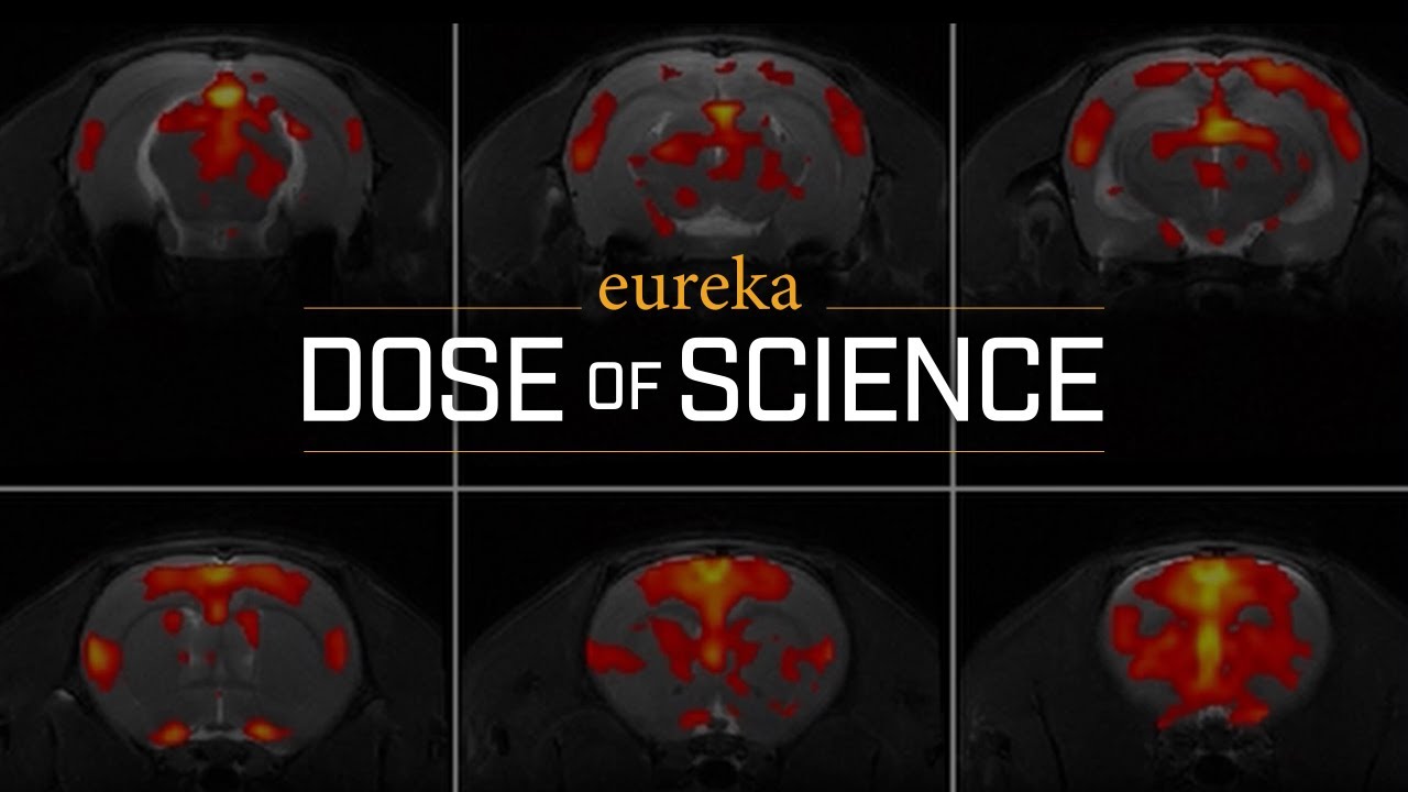The Future of Brain Imaging | Charles River's A Dose Of Science
