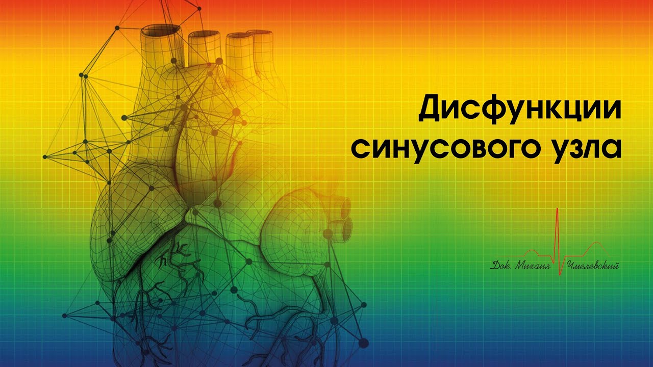 Дисфункции синусового узла