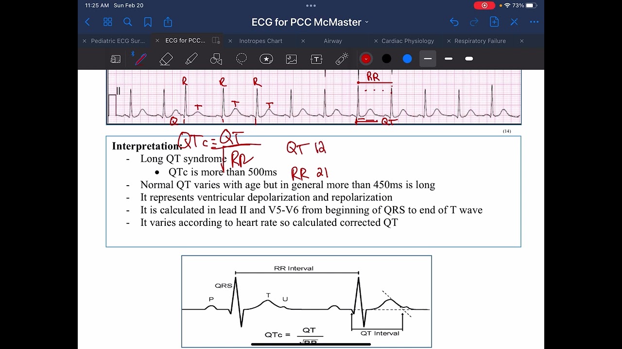 Calculating the QTc - Dr. Cynthia Cupido