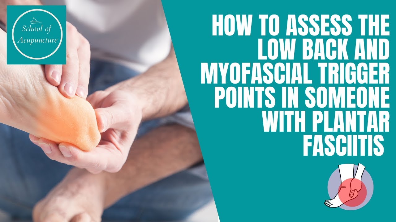 How to assess the low back and myofascial trigger points in someone with plantar fasciitis