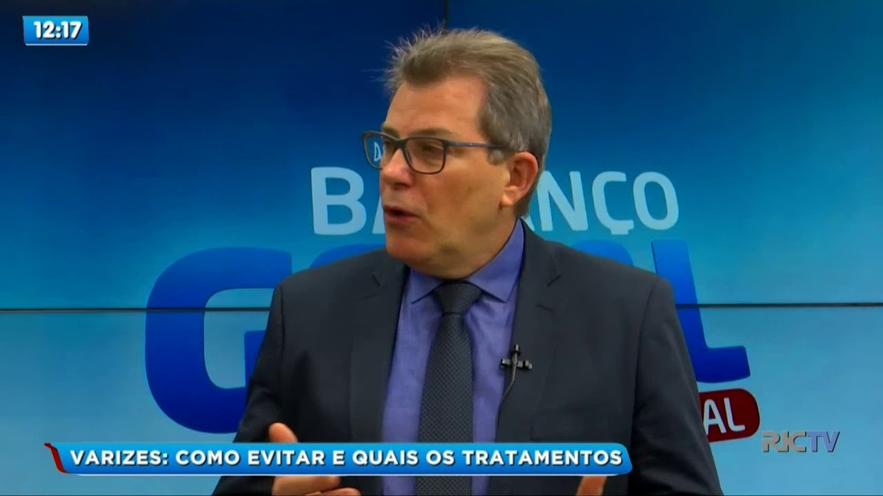 Varizes com m&eacute;dico angiologista Francisco Moreira