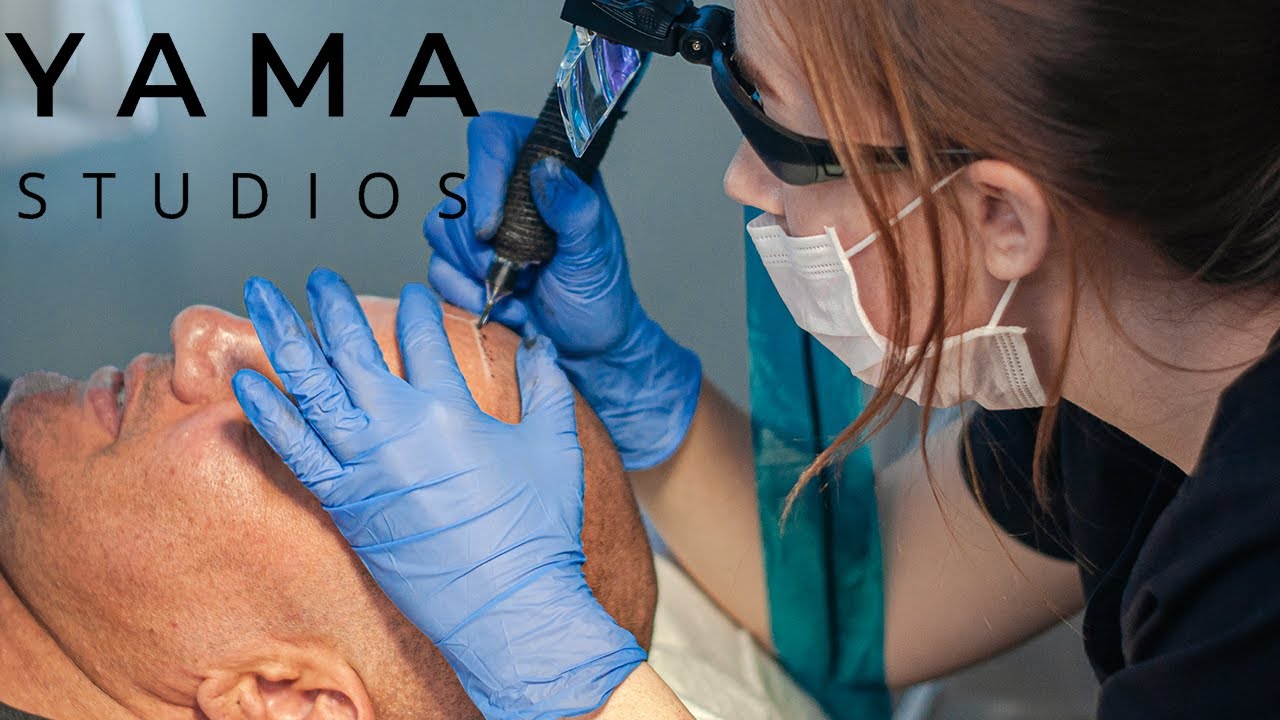 Does Scalp Micropigmentation Damage Your Hair Follicles? A Hawaii SMP Practitioner Explains