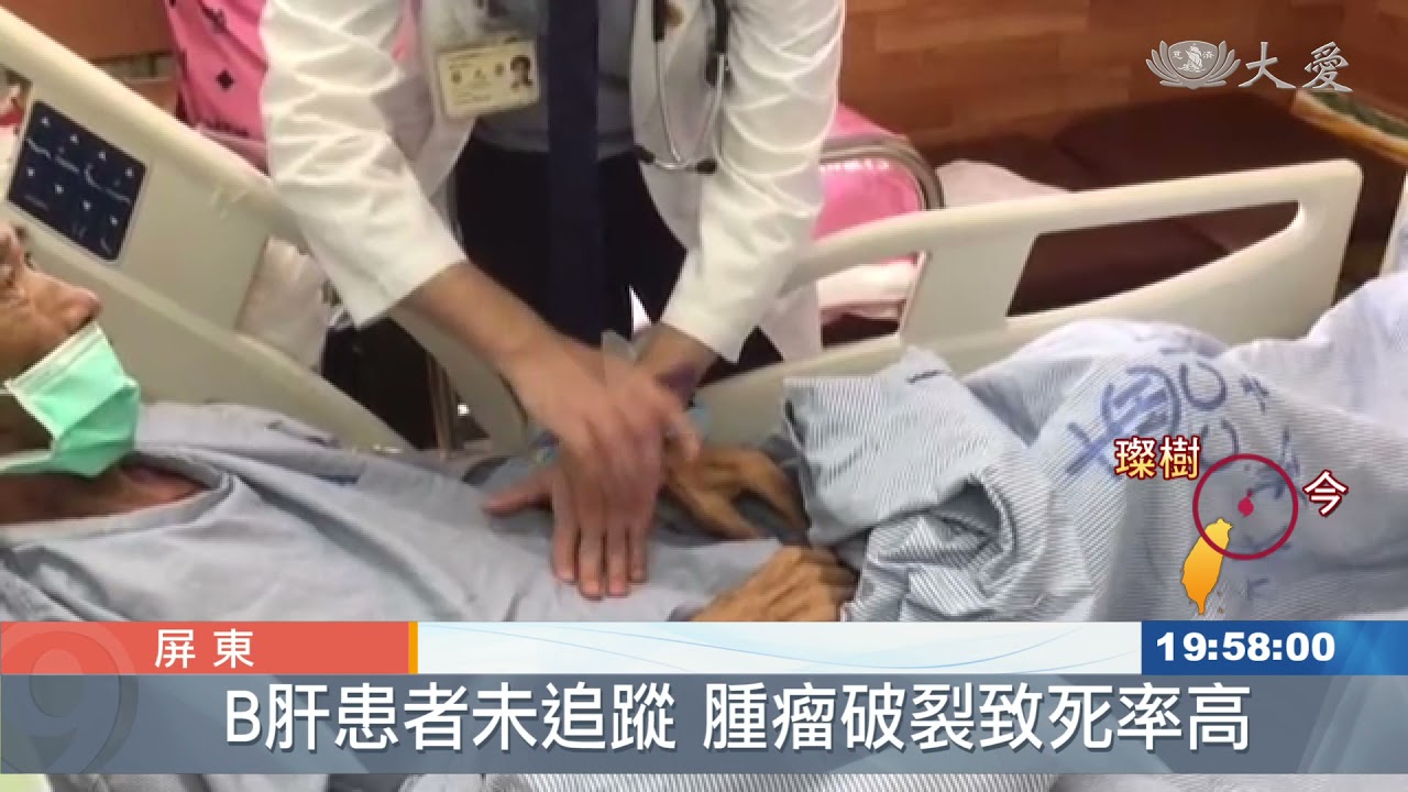 腹部不明瘀青 疑是肝癌警訊