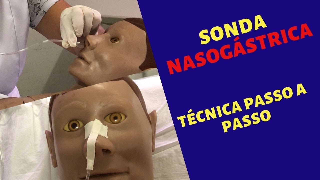 Como Passar Sonda Nasogástrica- Técnica completa #nasctreinamentosenfermagem  #enfermagem