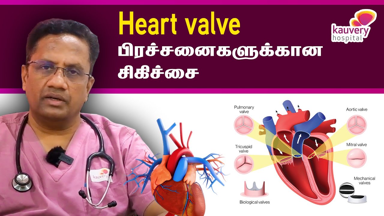 Treatment for heart valve problems | இதய வால்வு பிரச்சனைகளுக்கான சிகிச்சை