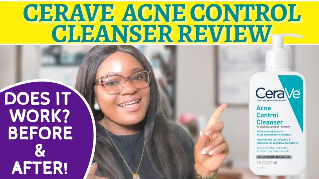 CeraVe Acne Control Cleanser Review | My Honest Results After 2 Weeks!