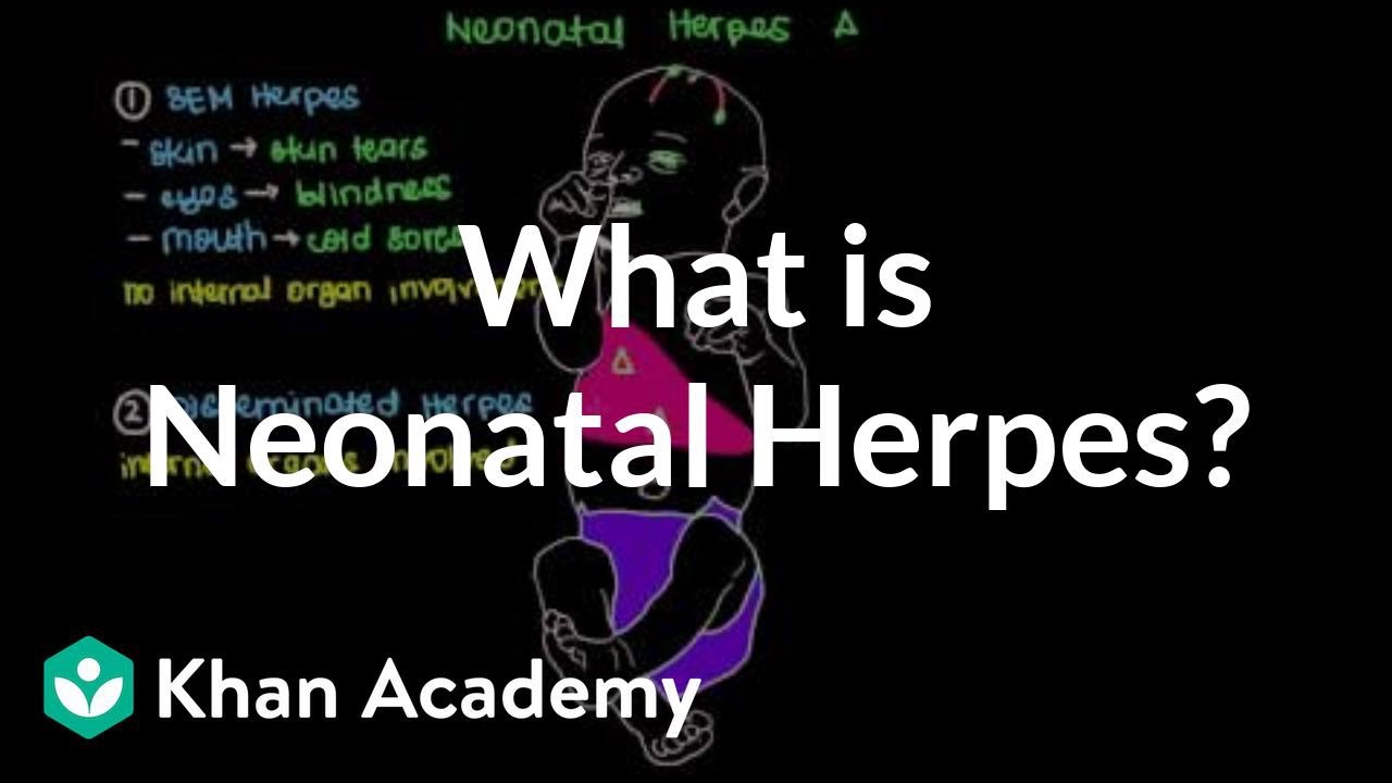 What is neonatal herpes? | Infectious diseases | NCLEX-RN | Khan Academy
