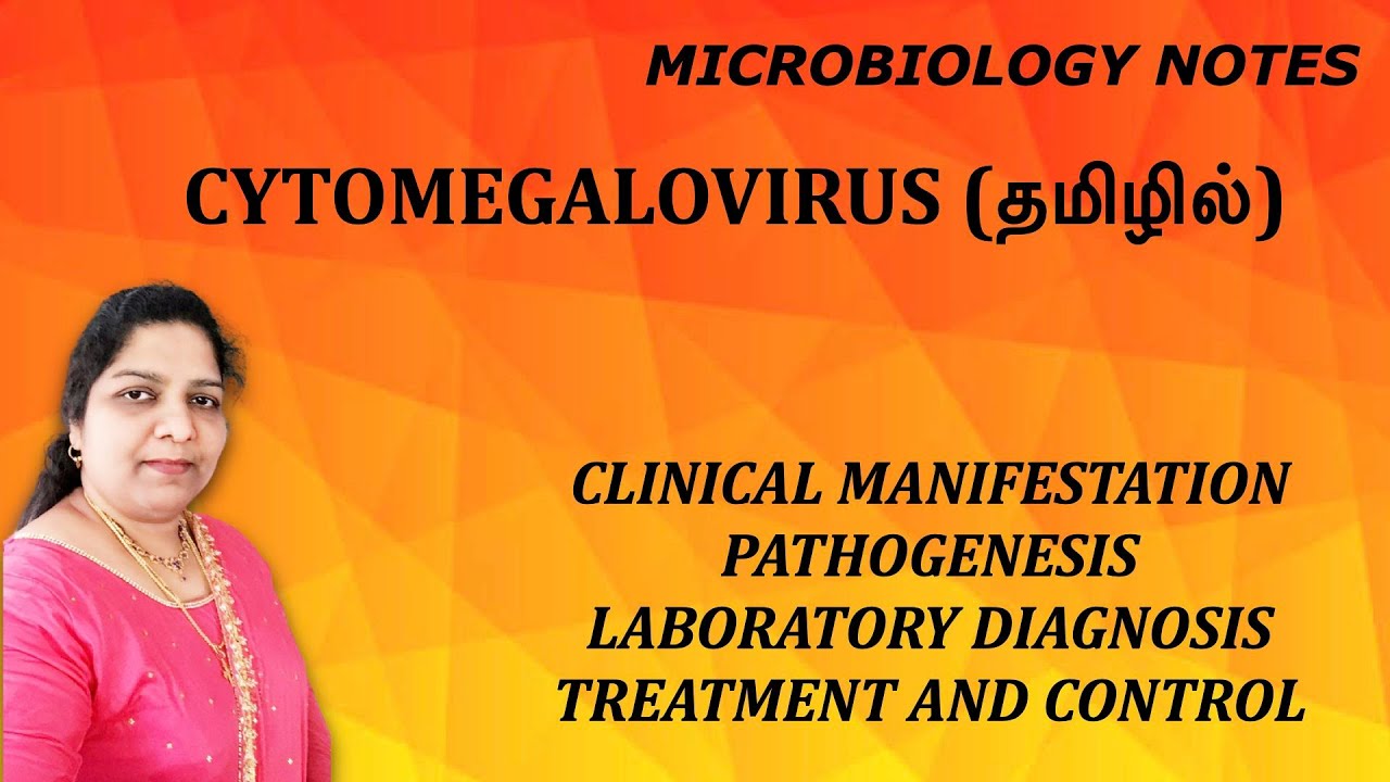 Cytomegalovirus (CMV) / clinical manifestations, pathogenesis, lab diagnosis & treatment / Tamil