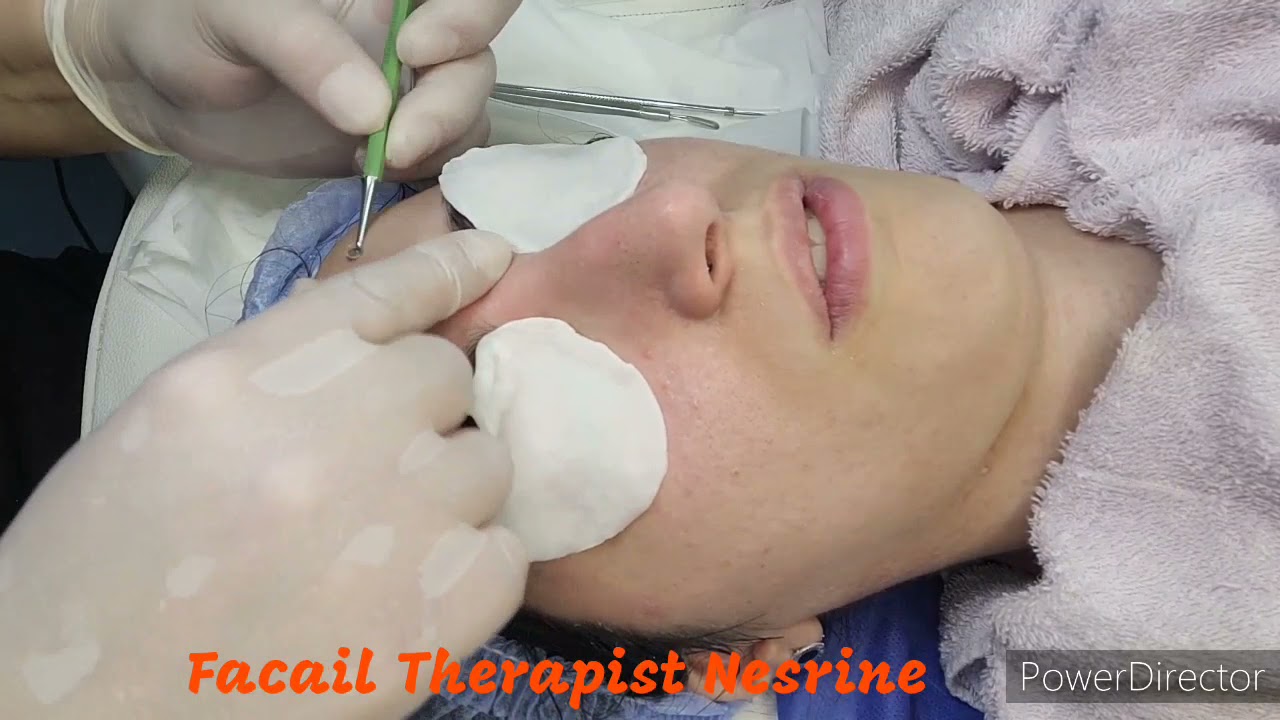 جلسة اليوم قبل و بعد تنظيف عميق و هيدرافيشل و أكسجين لنضارة فائقة للبشرة 🥰🥰🥰