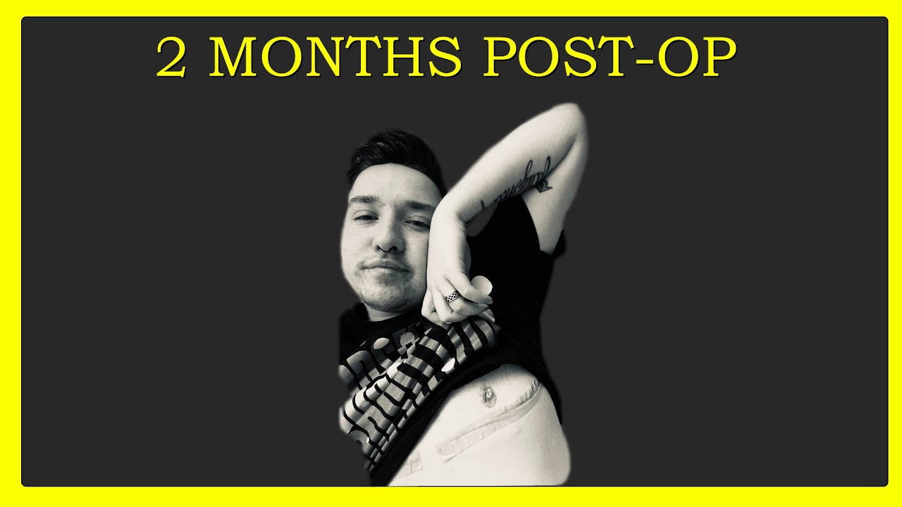 2 Months Post Op Top Surgery- FTM