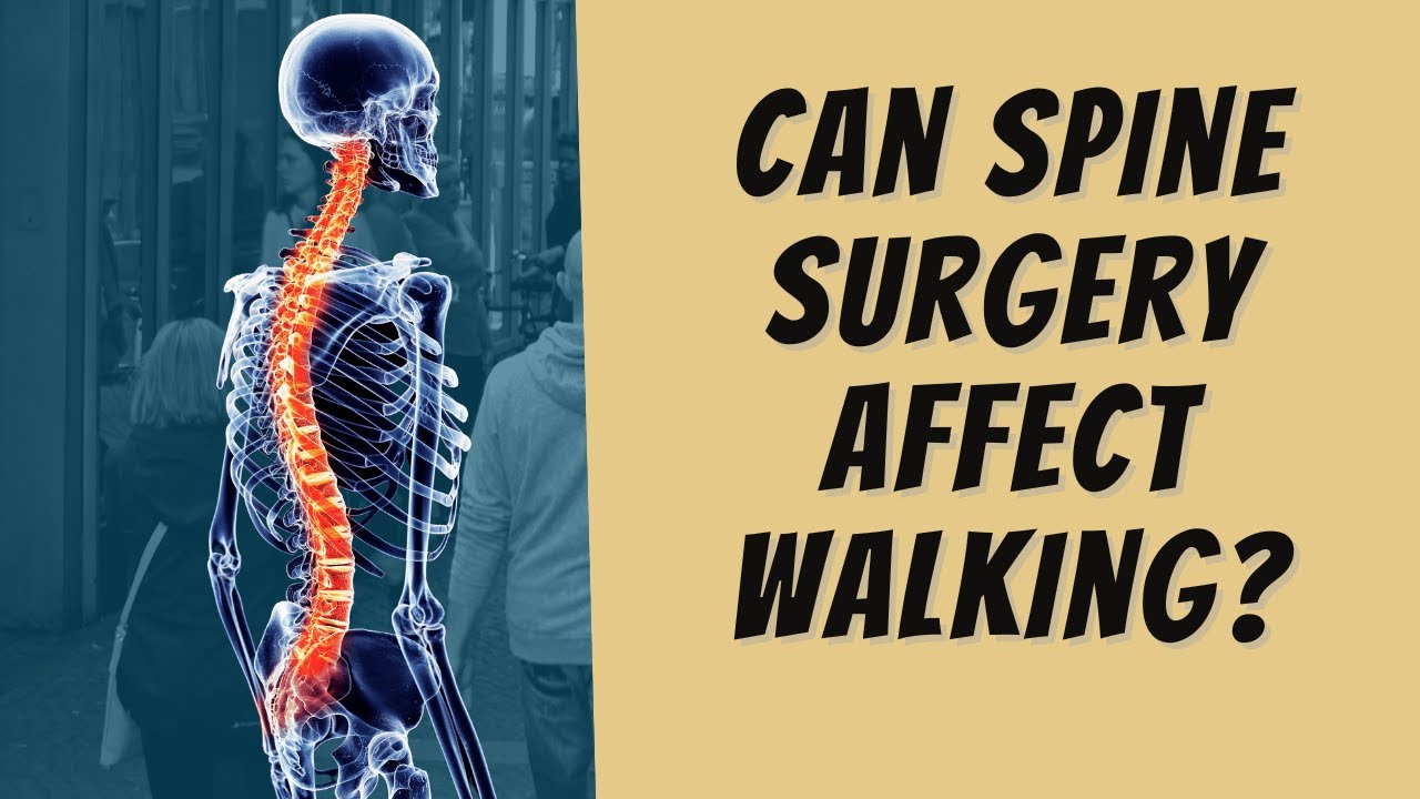 What they don't tell you about spine surgery and your mobility