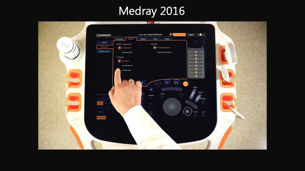 Carestream Touch Prime Ultrasound System