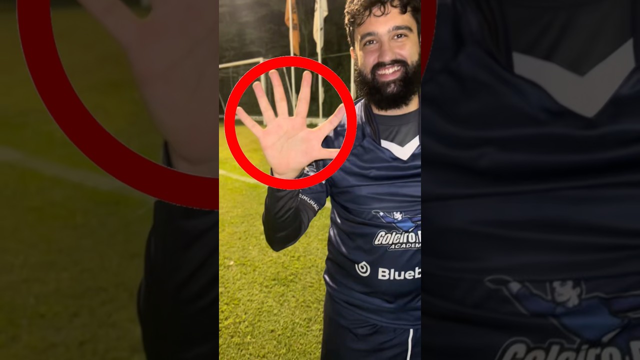Goleiro com 6 dedos 😳 