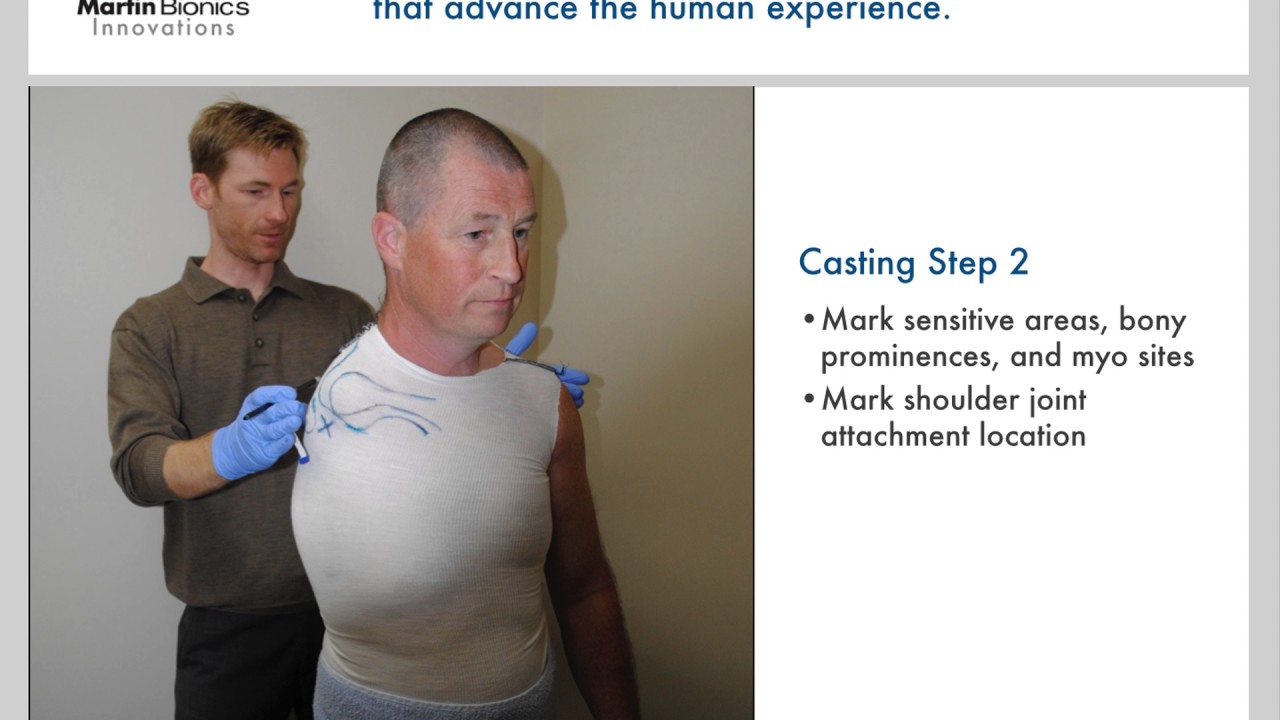 2 Casting