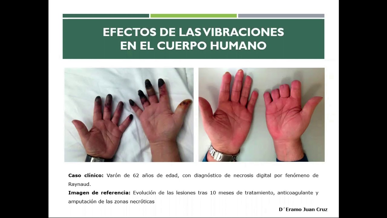 Clase medición de vibraciones