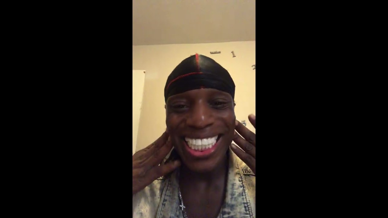 Shiny smile veneers review