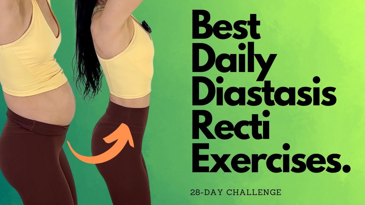 Heal & Flatten With These Daily Diastasis Recti Exercises!